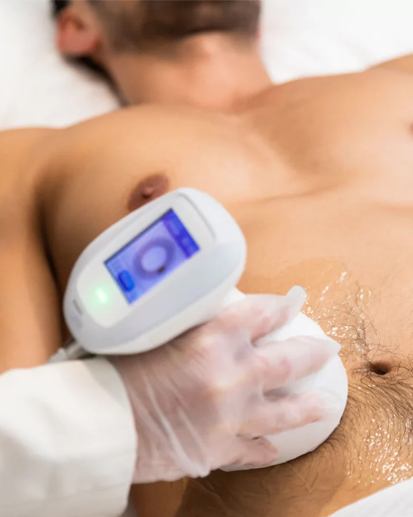 HIFU Body Contouring